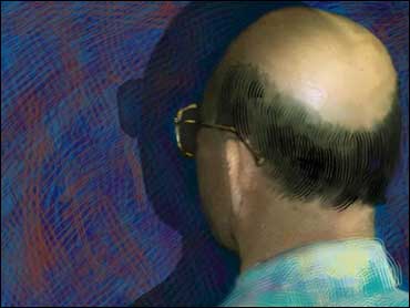Laser Comb, Cloning to Re-grow Hair? - CBS News
