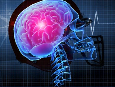 N.Y. high school football player dies after game - CBS News