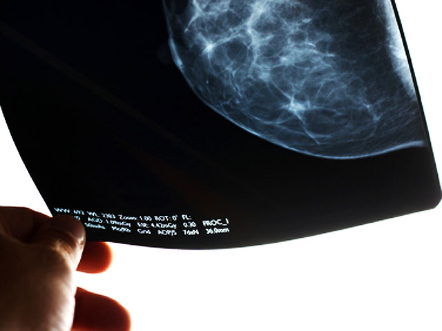 How mammograms help detect + prevent breast cancer - GVLtoday