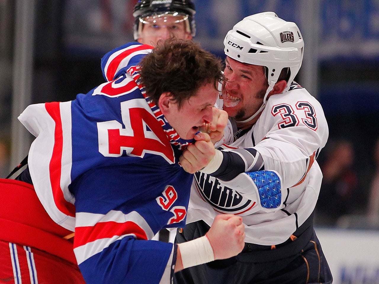 Cumulative Effect of Concussions - CTE - Derek Boogaard