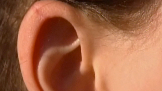 Elf ears: From sci-fi to real-life - CBS News