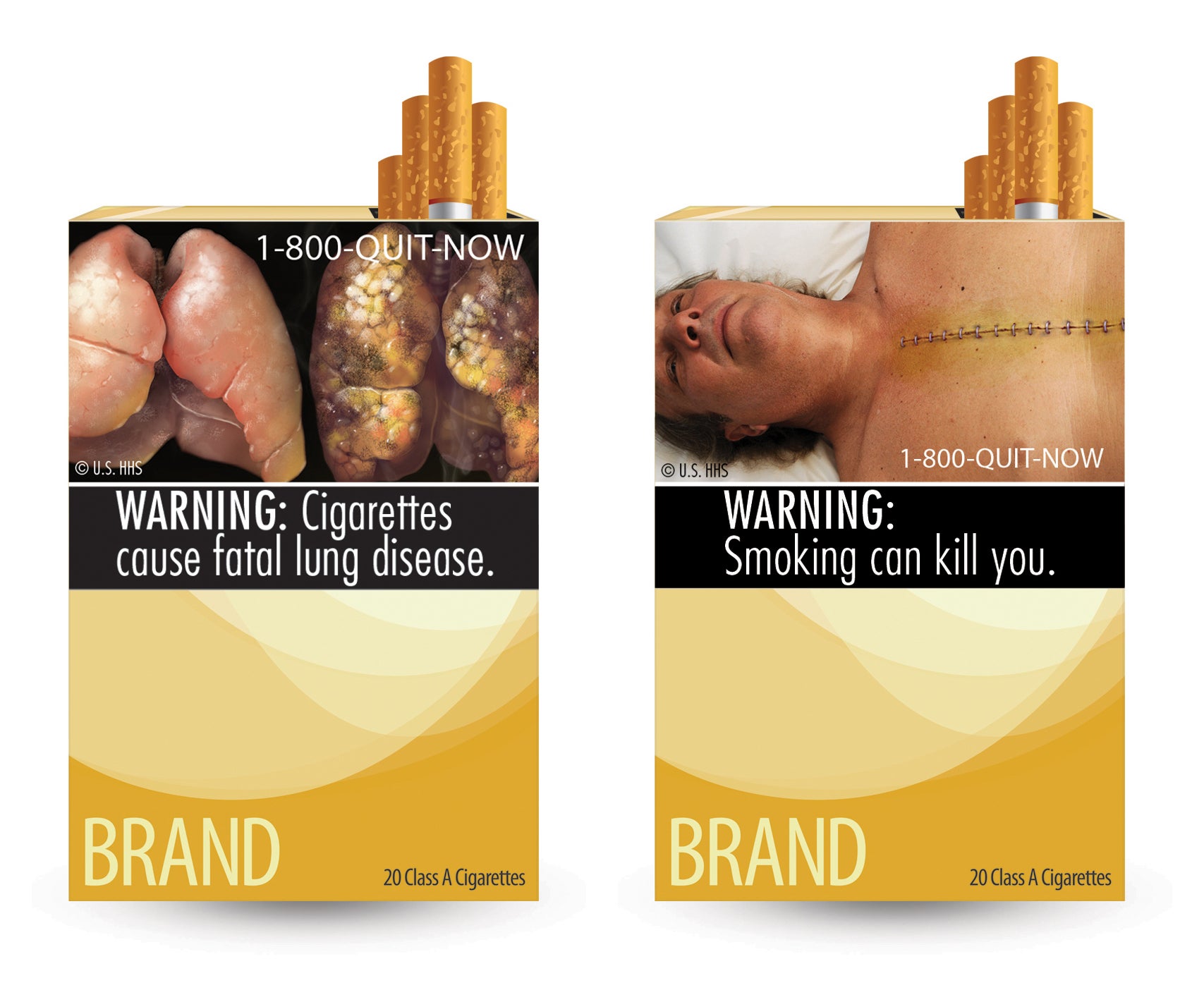 Tobacco warning labels around the world