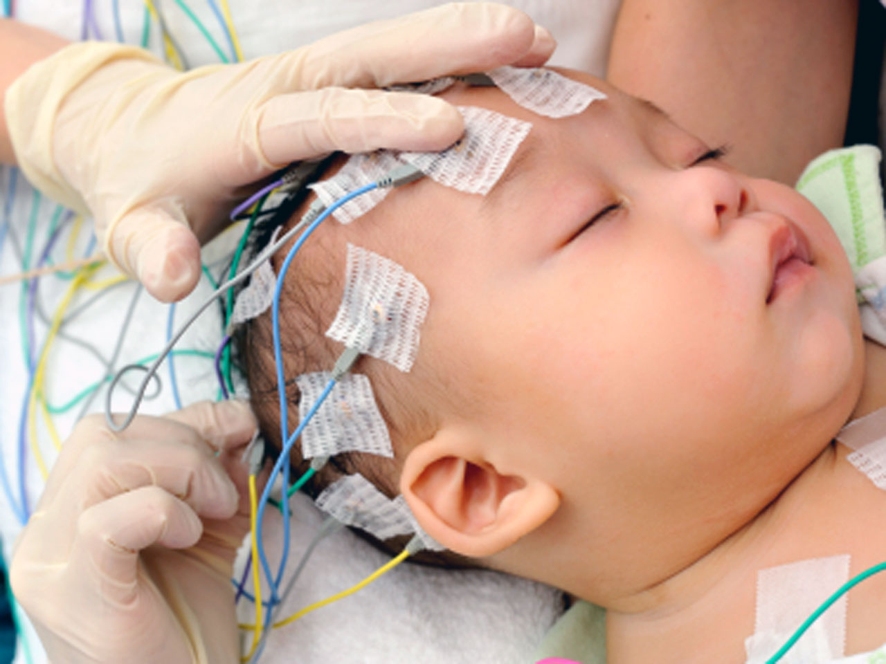 EEG brain scans may detect signs of autism in 2-year-olds - CBS News
