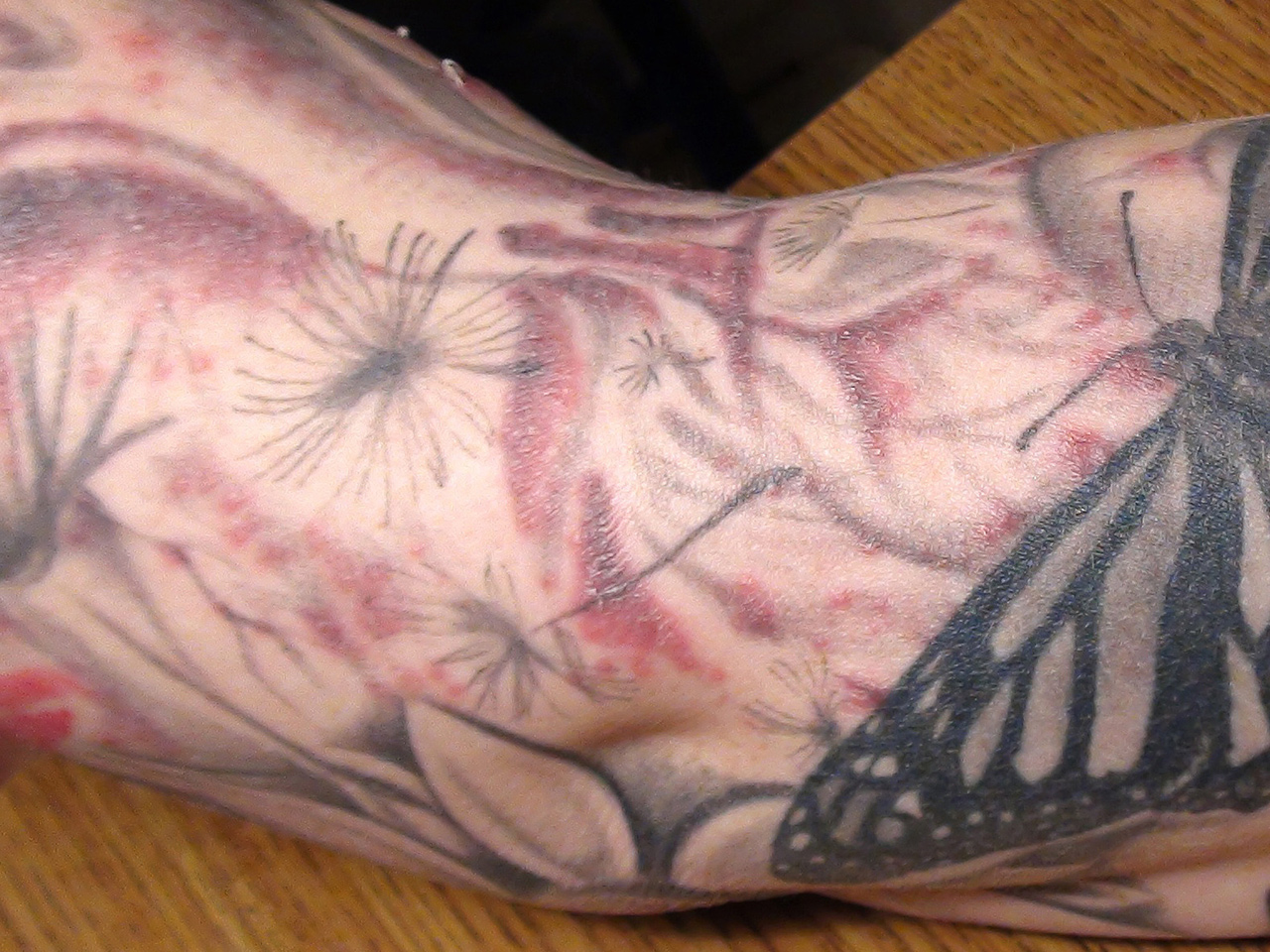 Tattoo ink causes health scare: How to identify infection and reduce your  risk - CBS News