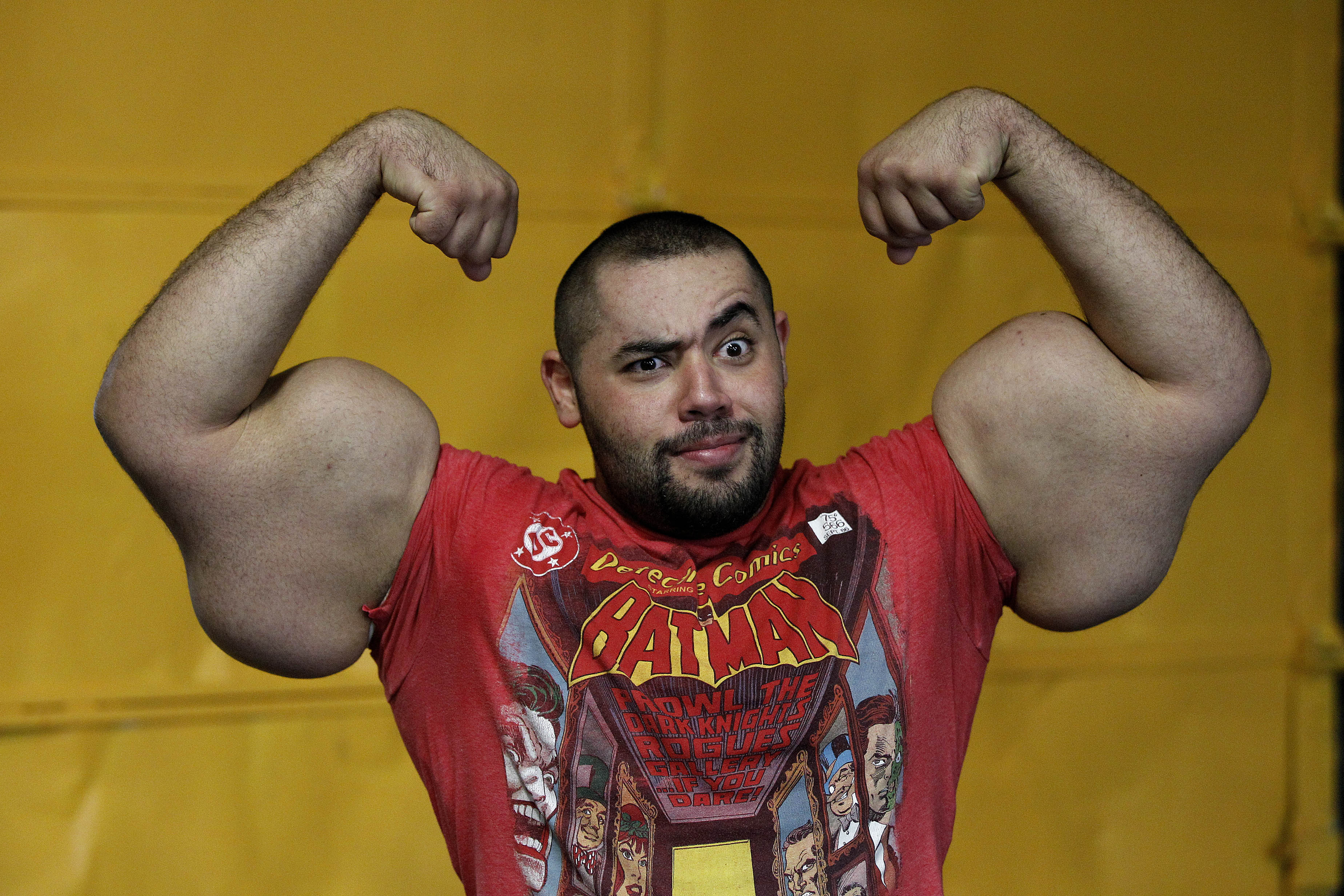 Egyptian Popeye Denies His 31 Inch Arms Are Fueled By Steroids Cbs News