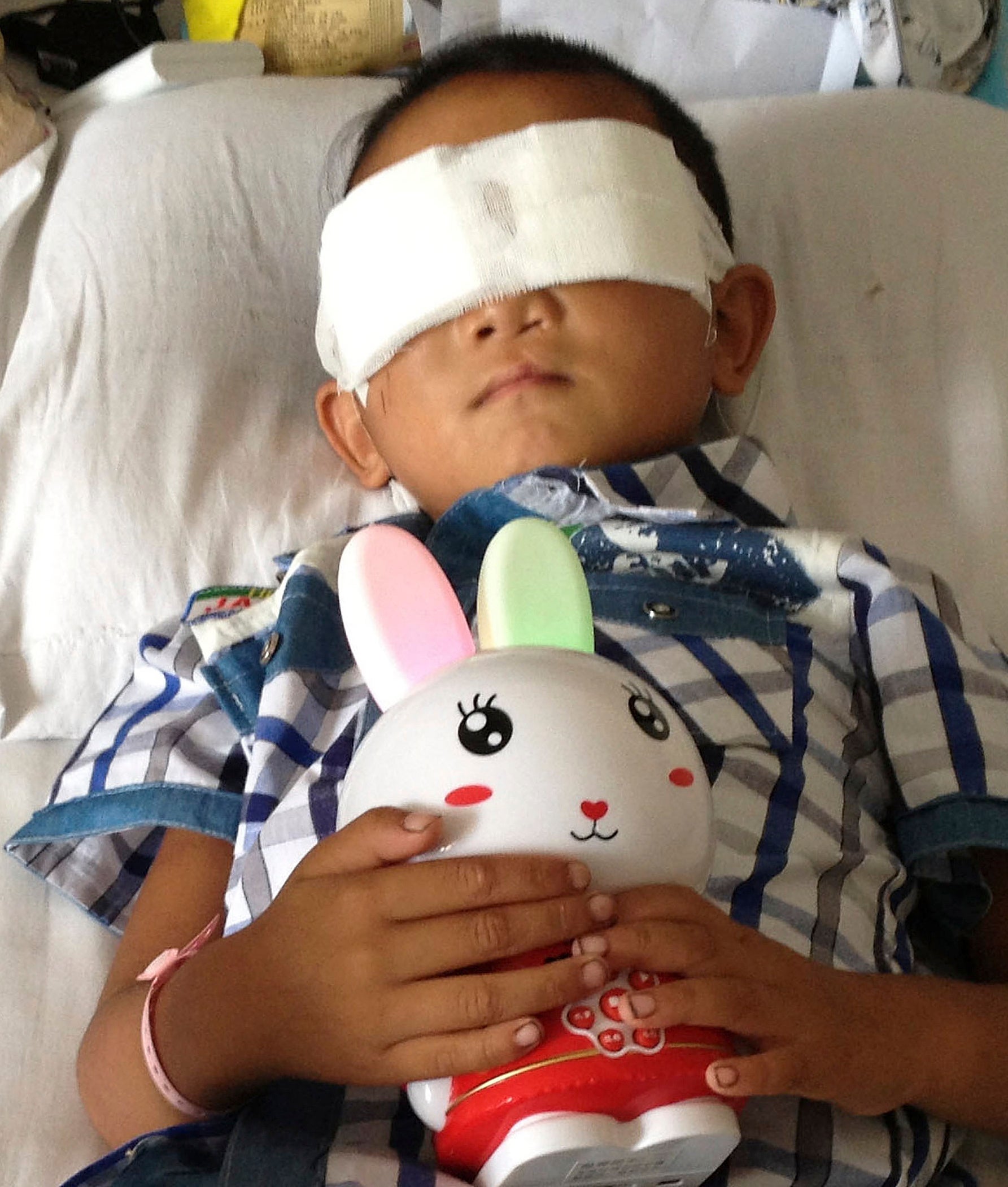 6yearold Chinese boy gets implants after eyes gouged out CBS News