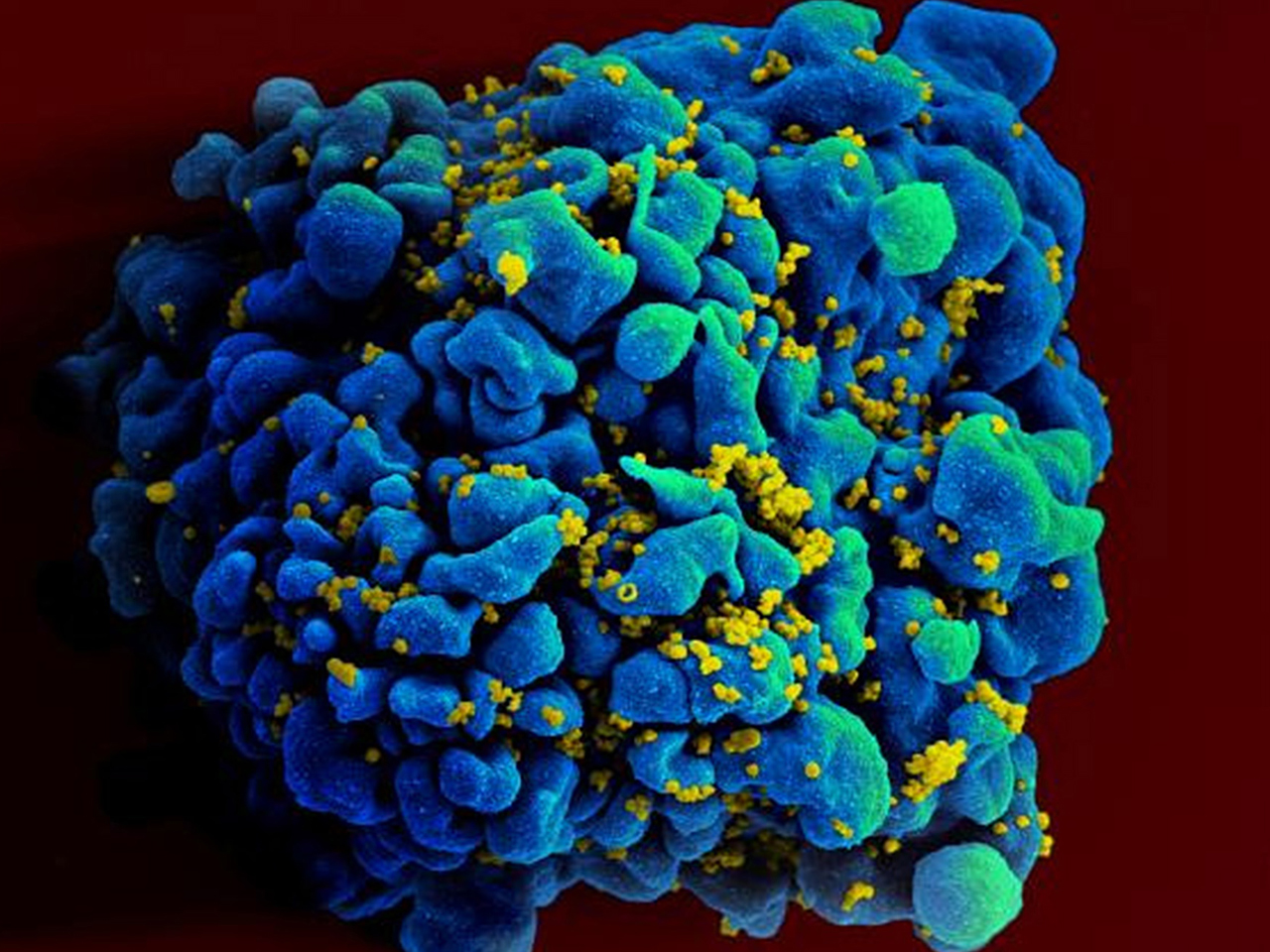 HIV-like virus suppressed in monkeys: Humans next? - CBS News