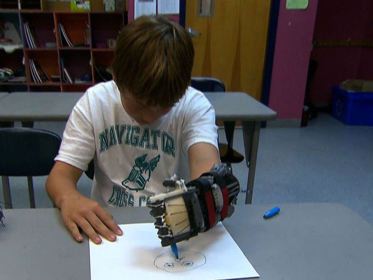 Morning Rounds: Can you DIY a bionic hand? - CBS News