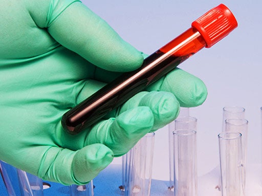 New mDETECT blood test helps with earlier cancer detection and