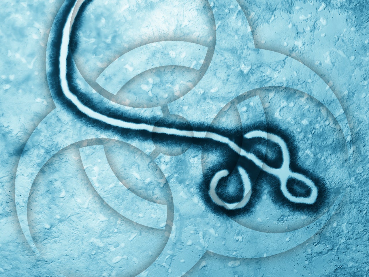 More studies needed on contagious Ebola virus and bodily fluids CBS News