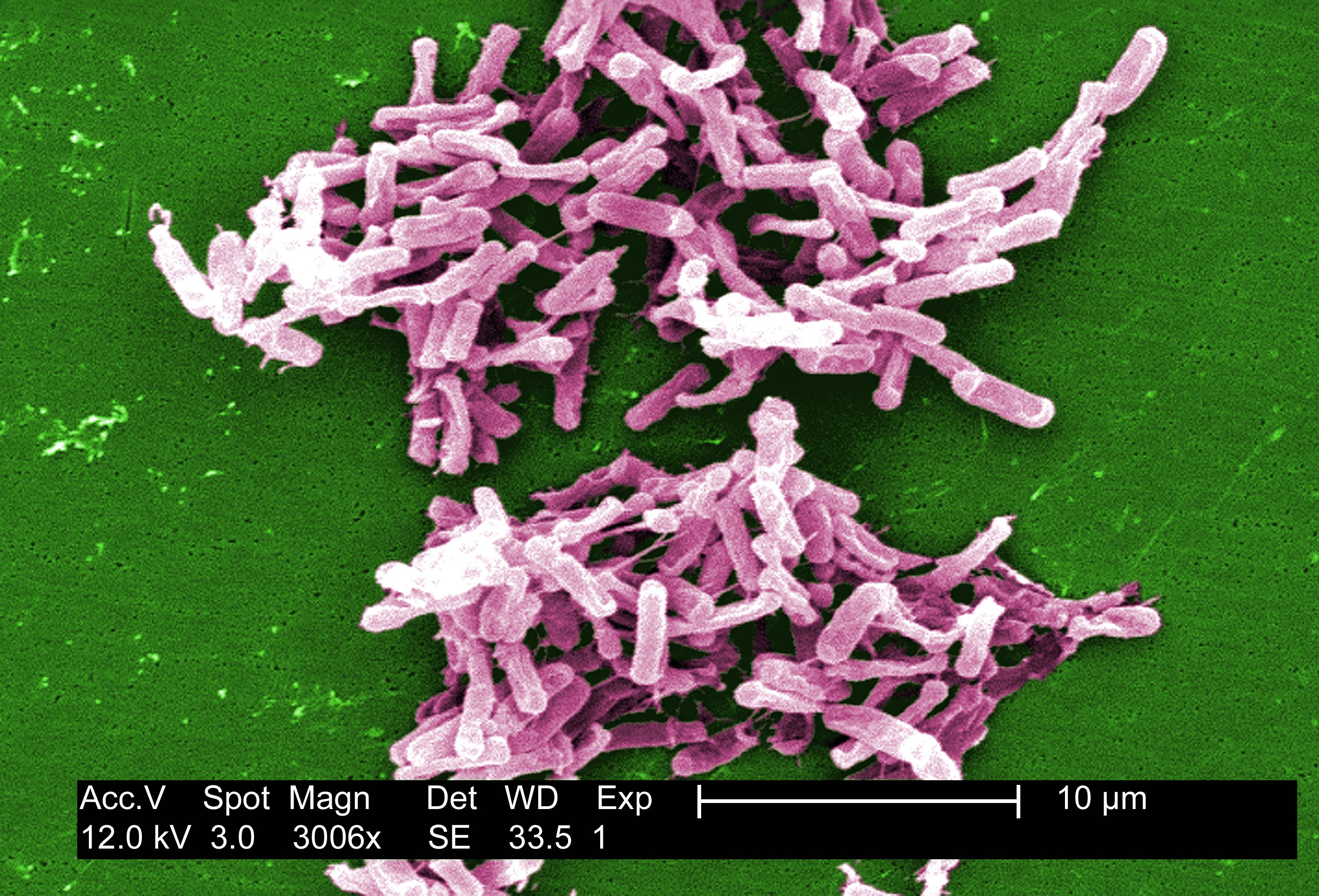 Nasty stomach bug C. diff. far more common CBS News