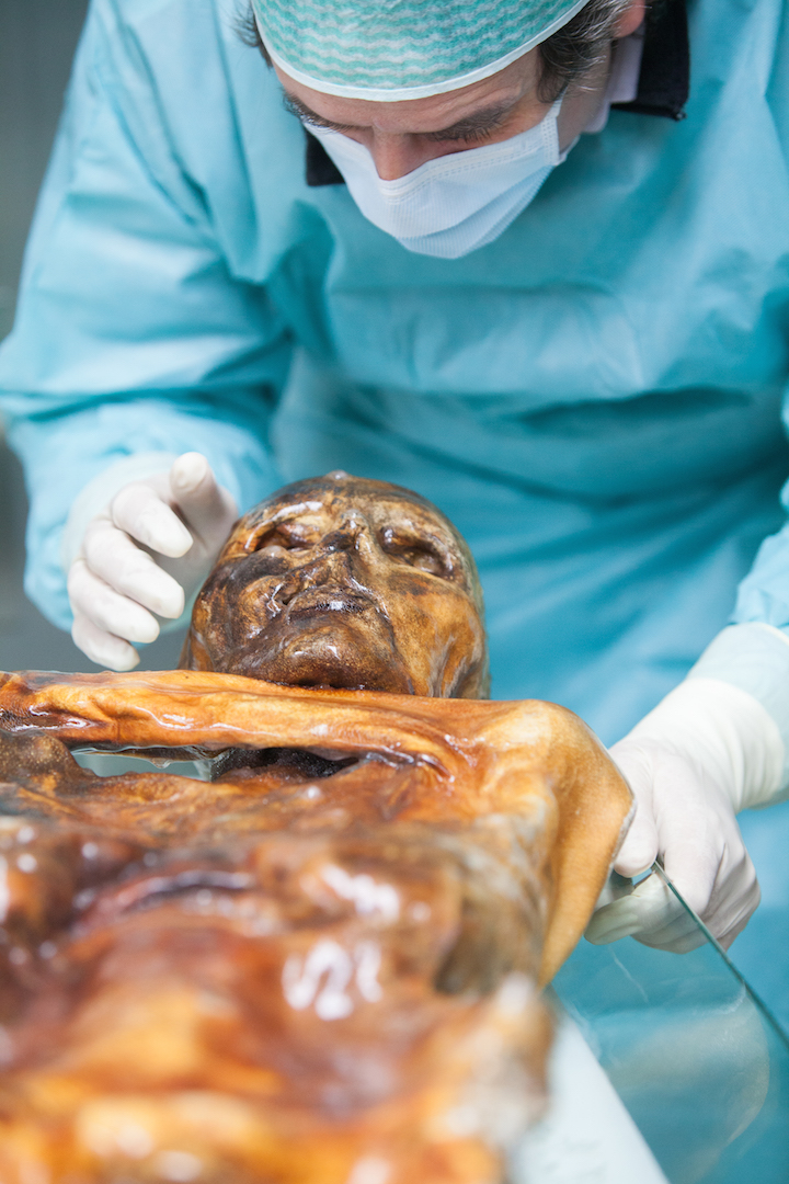 Secrets of 'Iceman': How a 5,300-Year-Old Mummy Sheds Light on