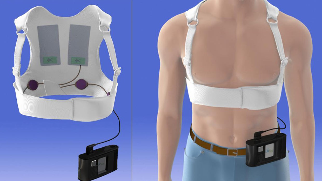 Wearable defibrillator may help some heart patients - CBS News