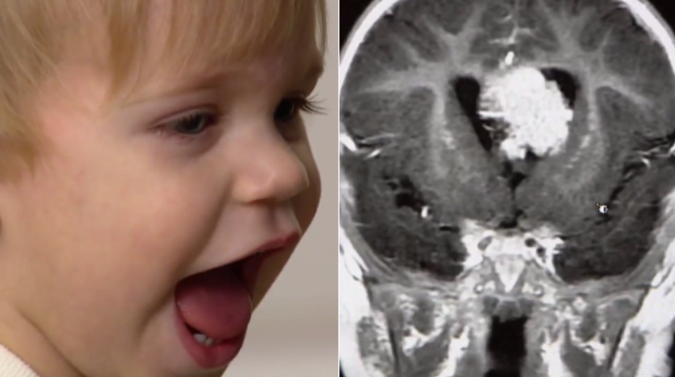 How a baby's accidental fall off a changing table ended up saving his life CBS News