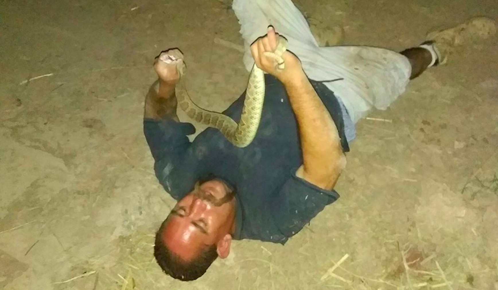 can you survive a rattlesnake bite