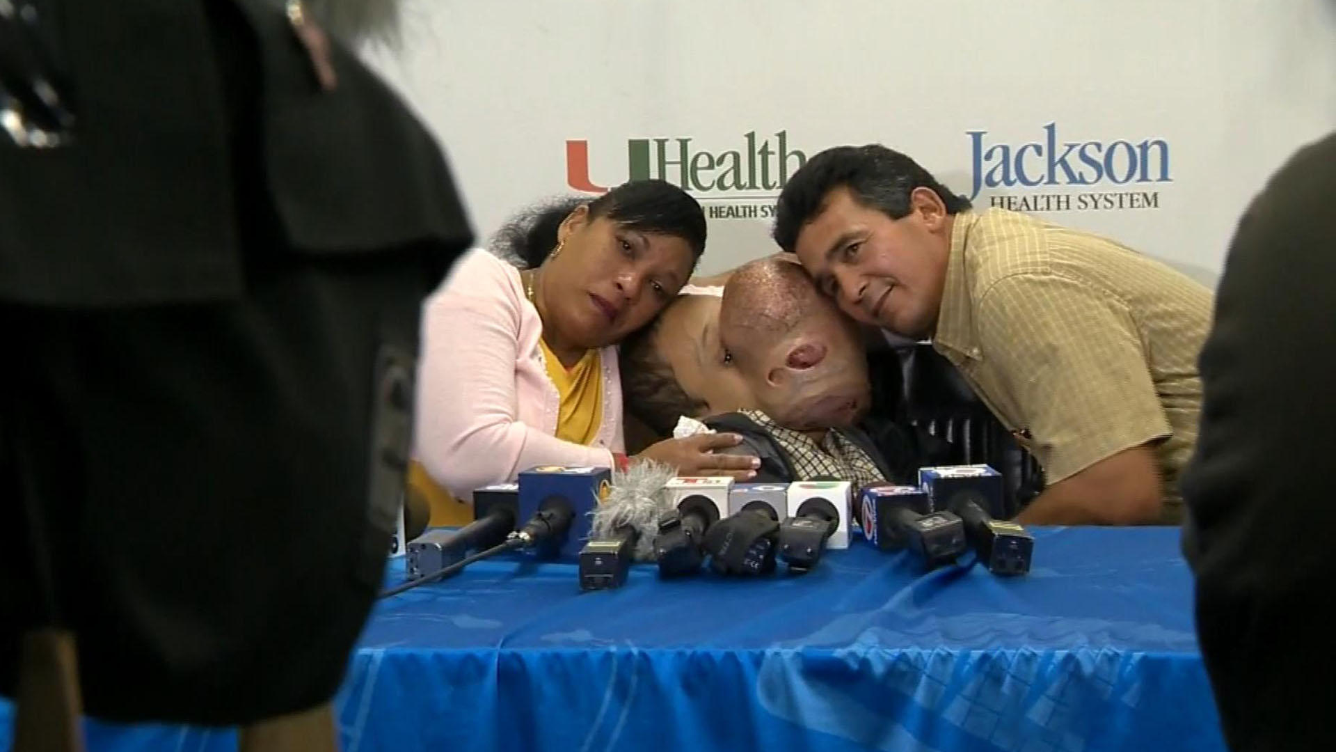 14 Year Old Boy Emanuel Zayas Dies After Doctors Remove 10 Pound Tumor From His Face Cbs News 2155