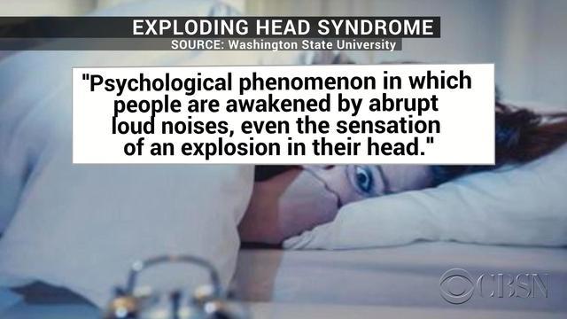 "Exploding head syndrome" is real, and surprisingly common - CBS News