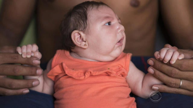 Zika virus declared a global health emergency - CBS News