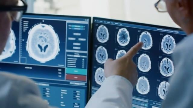 Researchers say new blood test can spot more than 50 types of cancer ...