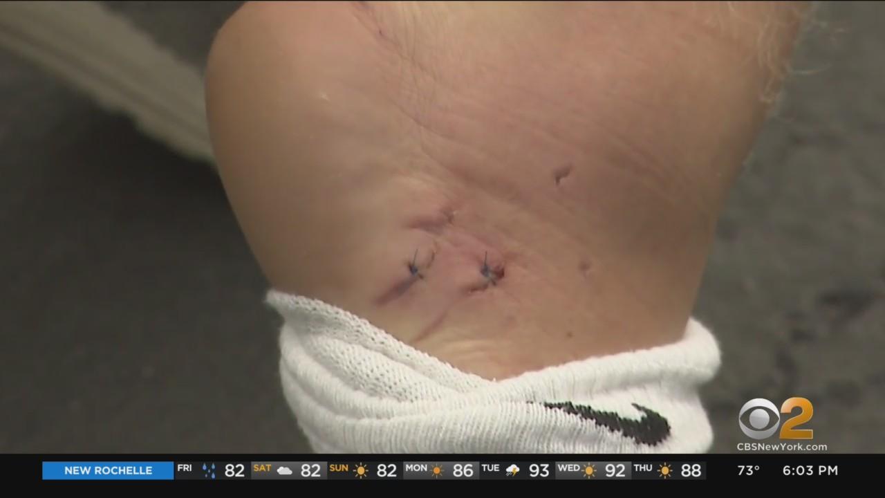 17yearold lifeguard bitten by shark during training off Ocean Beach(01)