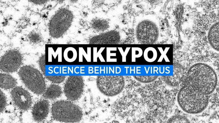 Everything you need to know about monkeypox - CBS Chicago