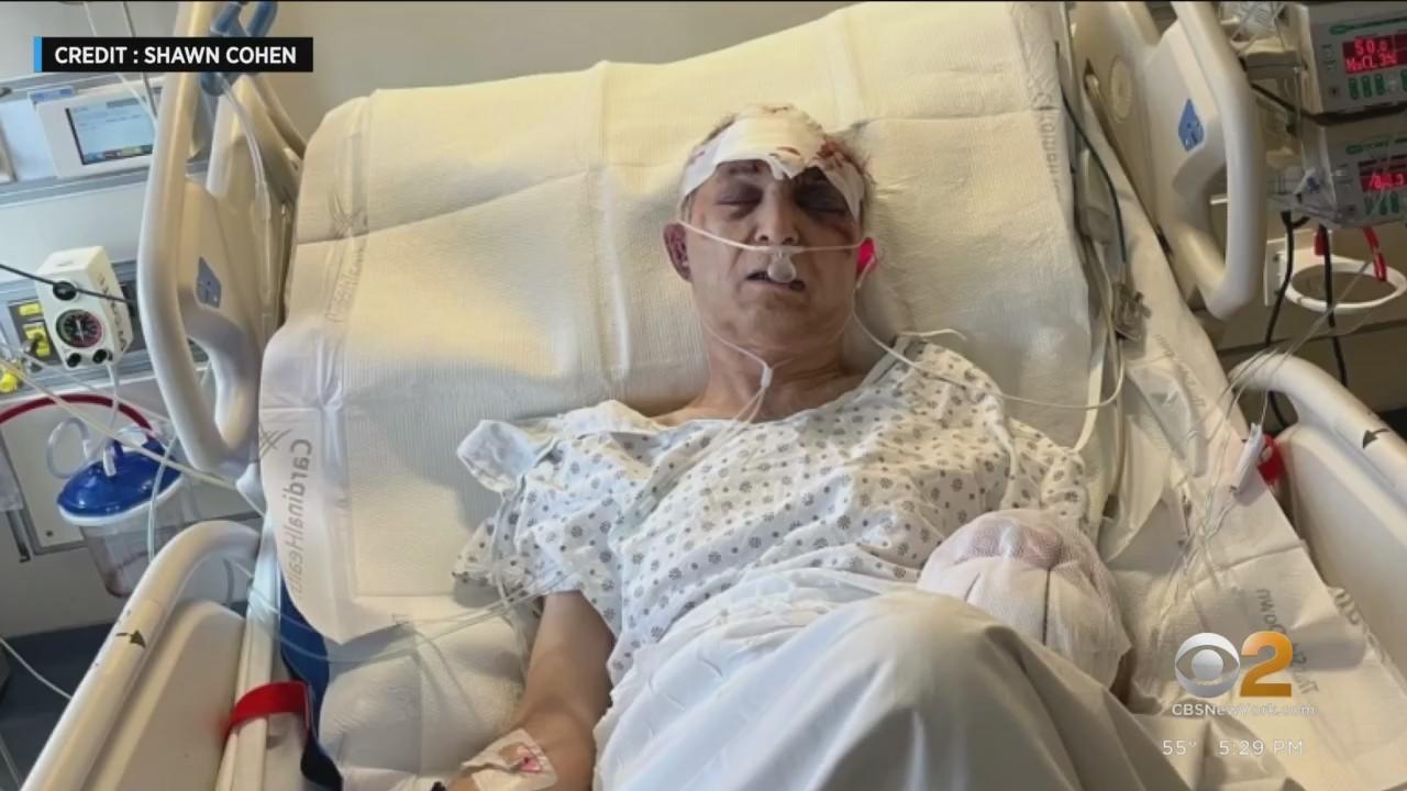79-year-old man hospitalized after being severely beaten in