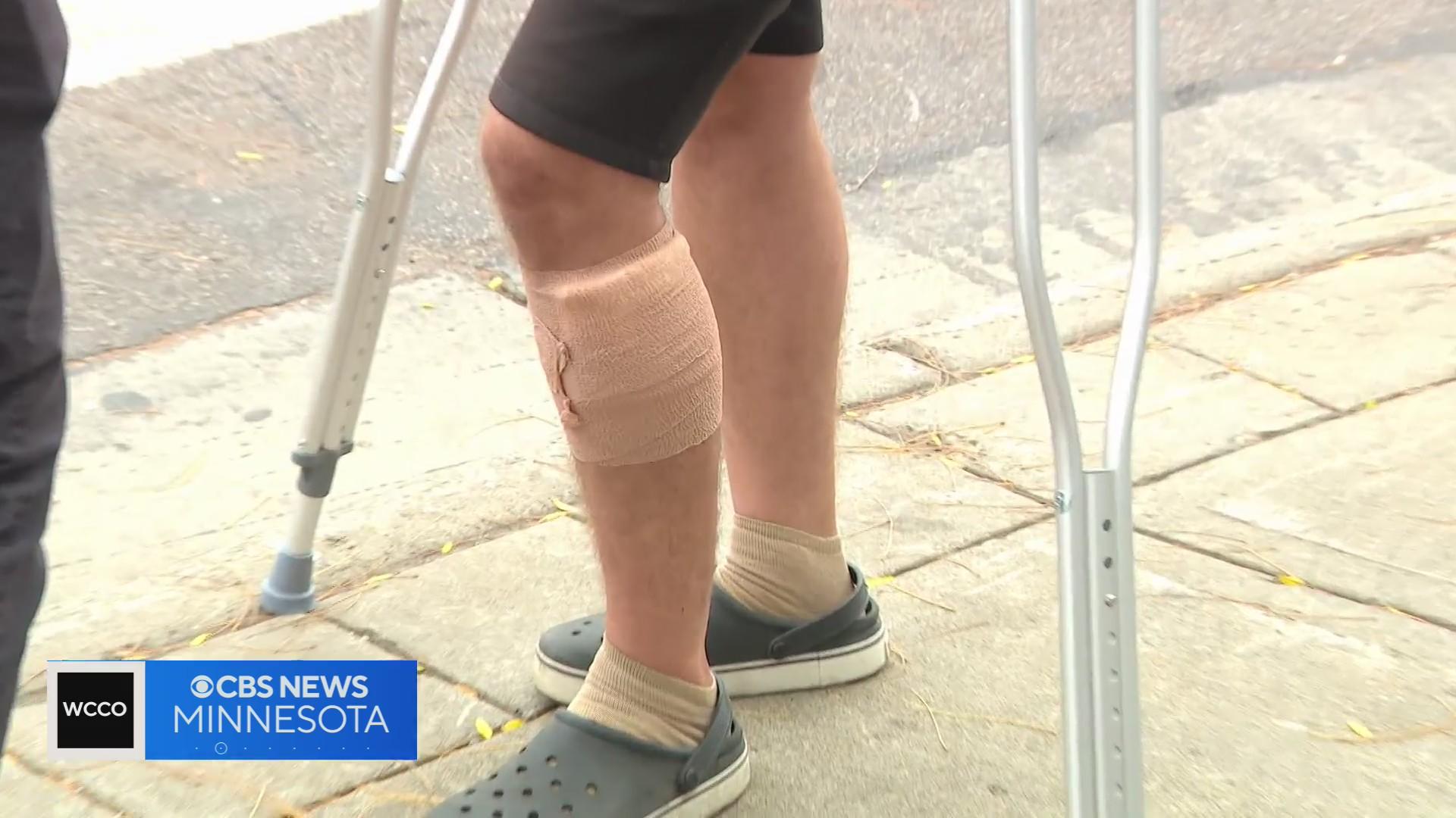 Minneapolis man has bullet lodged in leg after 4 shot in Lyn-Lake - CBS ...