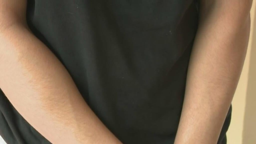 Teen girl speaks out after attempted abduction in South Miami - CBS Miami