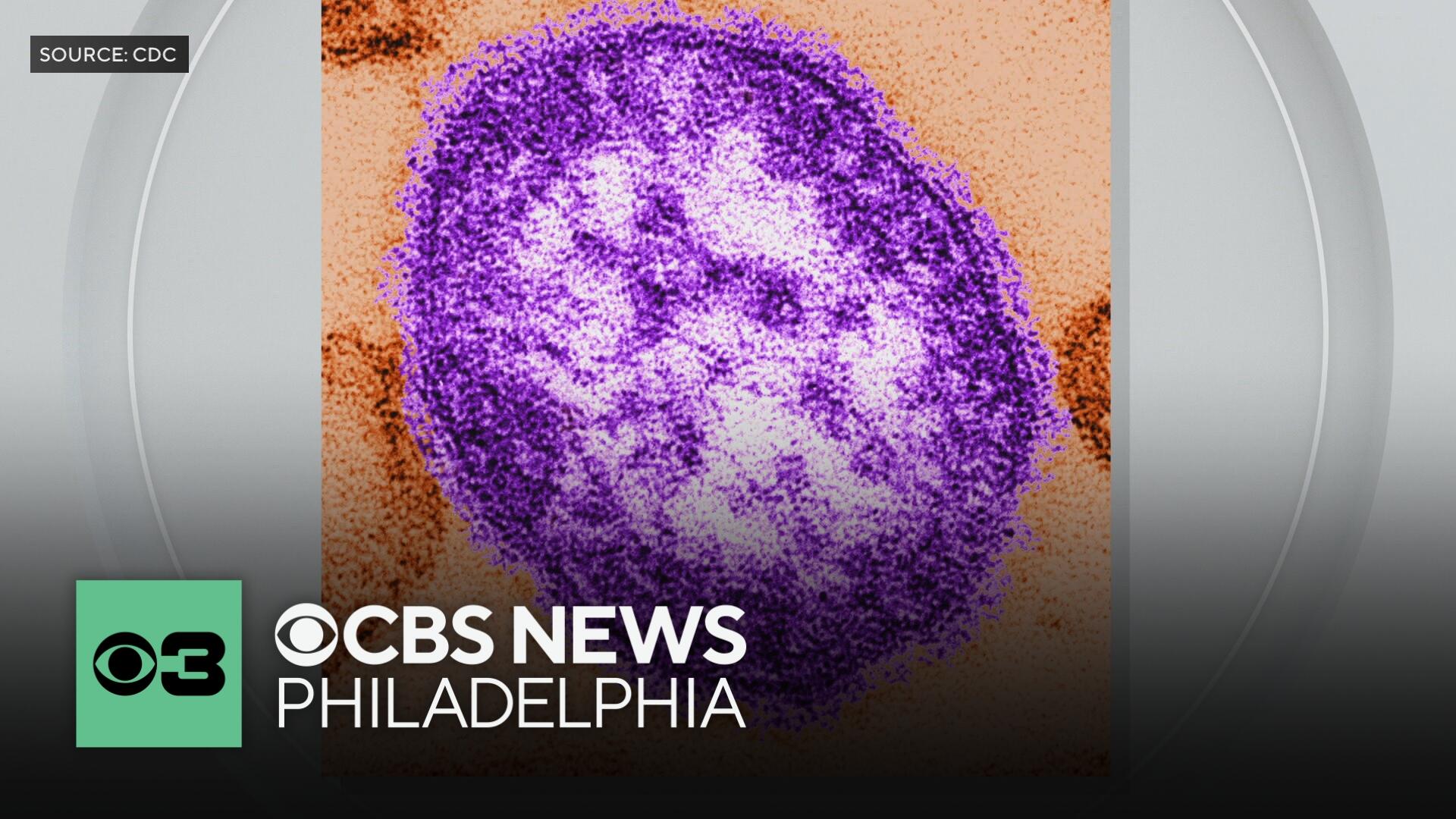 Philadelphia warns of possible measles exposure at 2 local hospitals