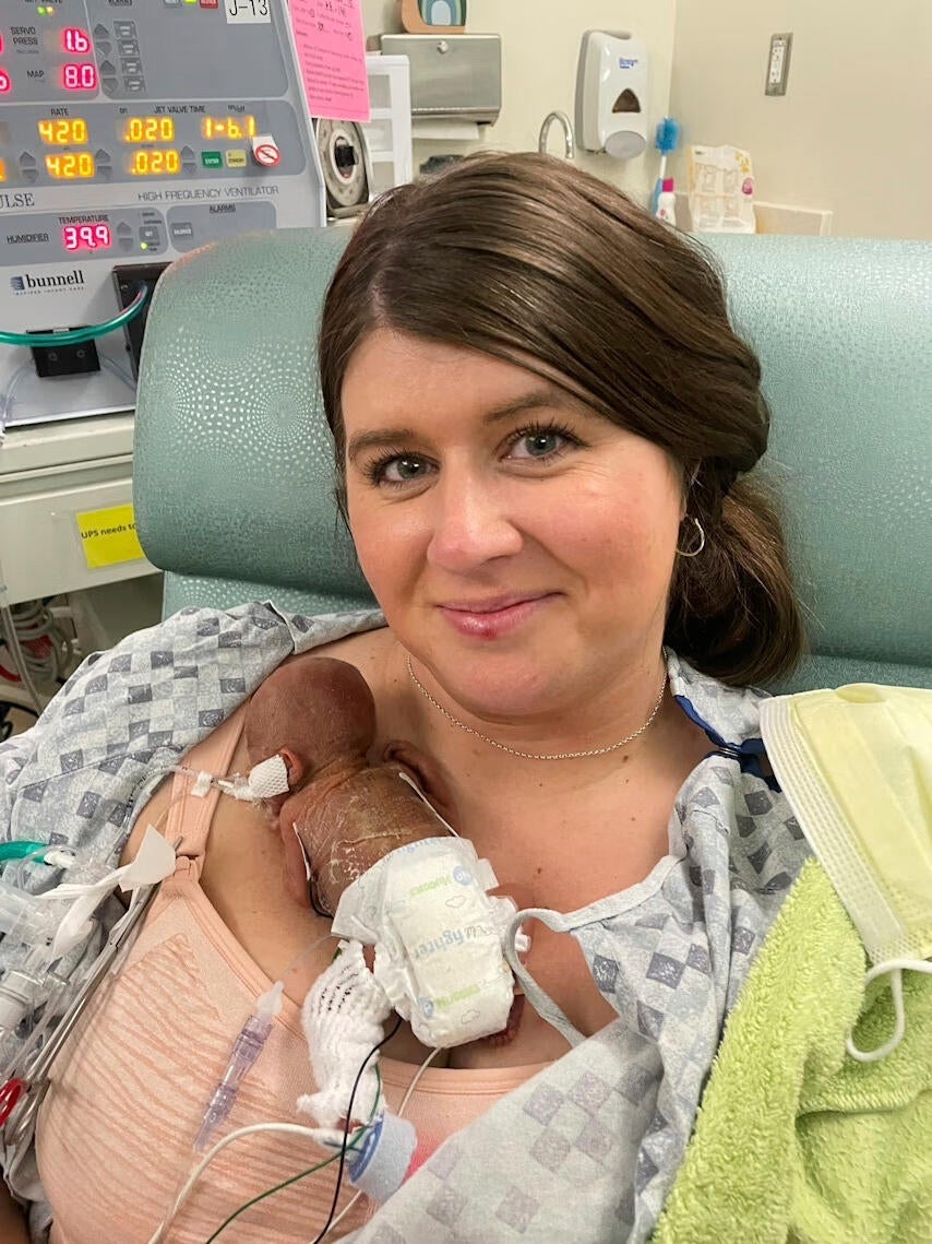 Premature Birth Record 