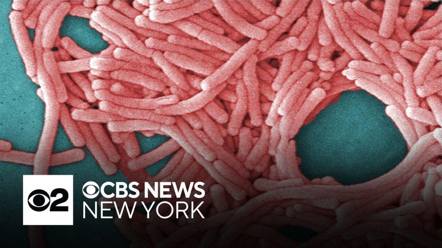 1 dead, nearly 2 dozen sickened in Legionnaires' disease cluster in