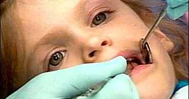 Fillings Without Drilling? CBS News