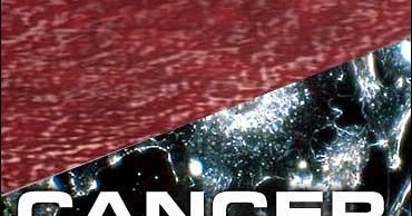 Processed Meats Tied To Stomach Cancer CBS News