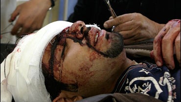 Ahmed Jamal, who was injured in a suicide bombing, receives stitches in a central Baghdad hospital in Iraq on Tuesday, Jan. 1, 2008. 