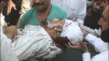 Pakistan paramedics and volunteers carry an injured victim of suicide bombing at a local hospital in Peshawar, Pakistan 