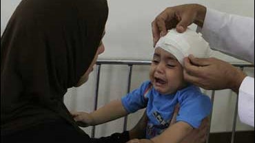 A young girl is treated for wounds in a hospital in Baghdad 