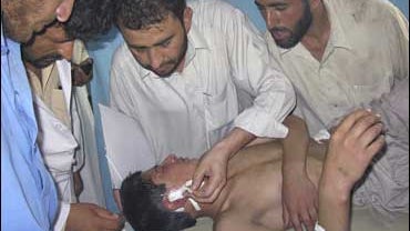 An Afghan boy is treated at a hospital in Jalalabad city, Afghanistan 