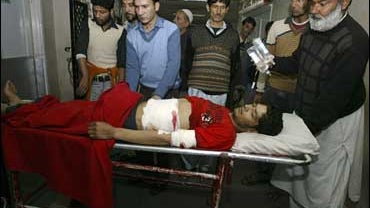 Kashmiri civilians take an injured man, Manzoor Ahamed, for treatment at a hospital in Srinagar, India 