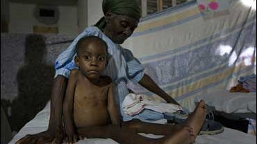 Mackenson Duclair, 5, who suffers from malnutrition, sits in a bed with an unidentified woman at the Doctors Without Borders hospital in Port-au-Prince 