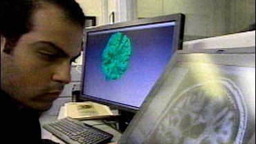 Doctors studying amnesia, memory and the brain 