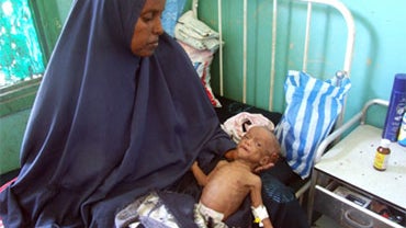 A Somali woman holds her malnourished child at Banadir hospital in Mogadishu, Somalia,Wednesday, Aug. 26, 2009. Somalia is facing its worst humanitarian crisis in 18 years, with more than half of the population needing humanitarian aid amid an escalating  