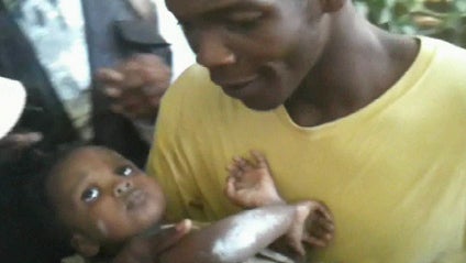 "Miracle Baby" Michelle, almost 2, being carried by her father after being pulled from under rubble five days after the haitian quake 