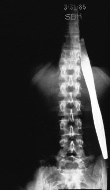 Shocking medical scans