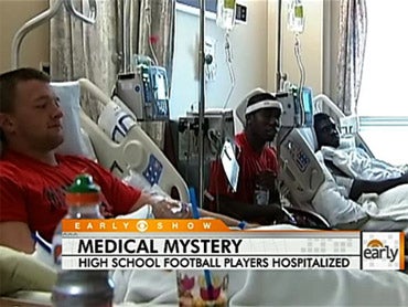 Some of 19 McMinnville (Oregon) High School football players sent to hospital after experiencing mystery swelling of upper-arms 