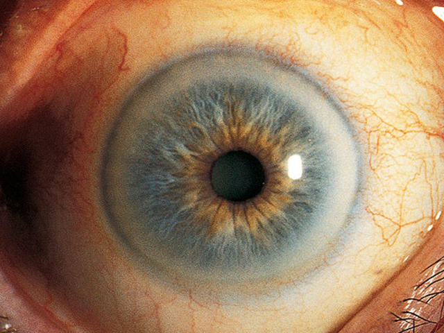 Doorweekt verstoring Rimpels 12 scary things your eyes say about your health