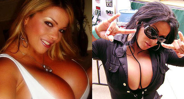 Sheyla Hershey, woman with world's largest breasts, before she had them removed. 