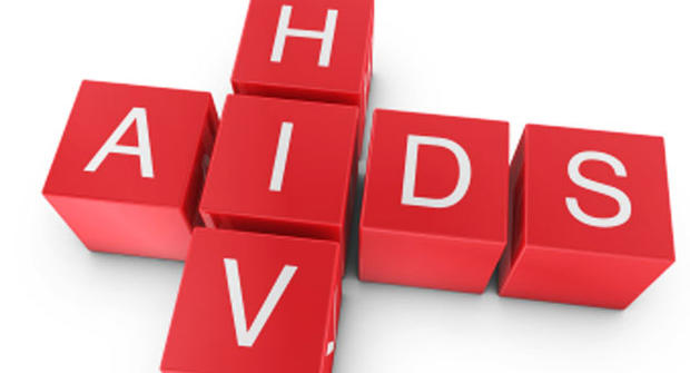 HIV, AIDS 