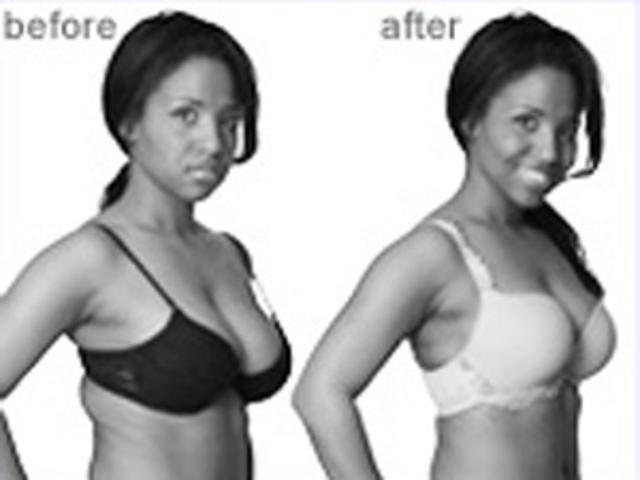 A Guide To Chicago Bra Fittings - CBS Chicago