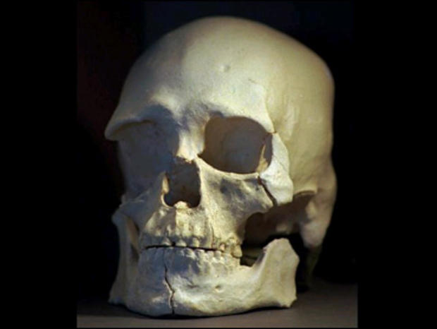 Fla. Couple Buys Real Human Skeleton at Yard Sale for $8 