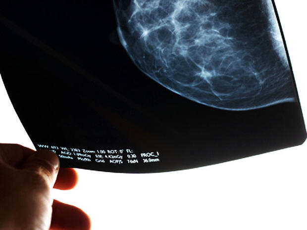 mammogram-2-4x3.jpg 